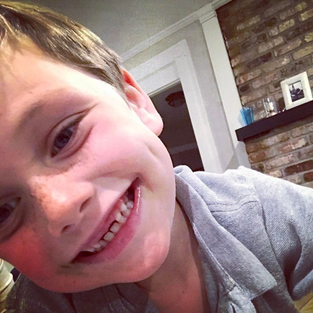asher's two front teeth
